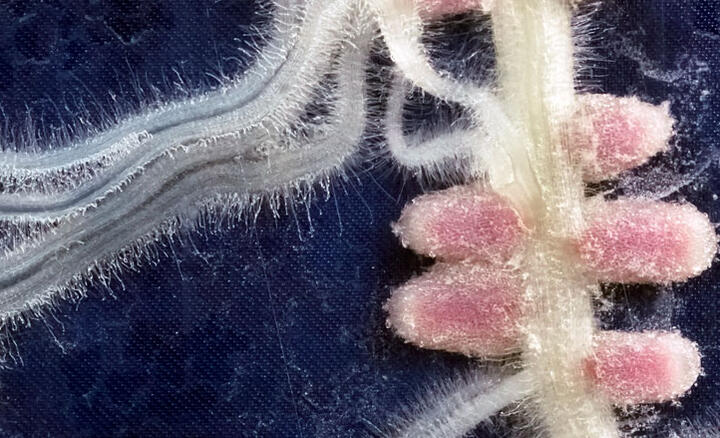 Nodules (pink) formed by nitrogen-fixing soil bacteria on a leguminous plant's roots (white).