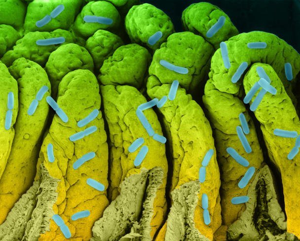 Bacteria E.Coli