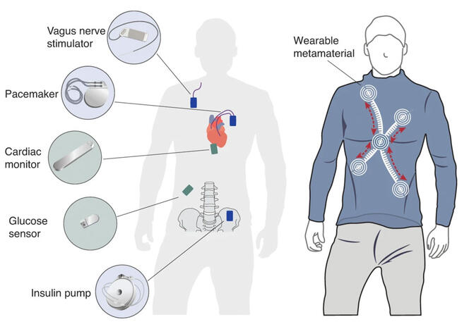 次世代医療インプラントのエネルギー供給最適化の理論枠組み (Medical implants of the future)