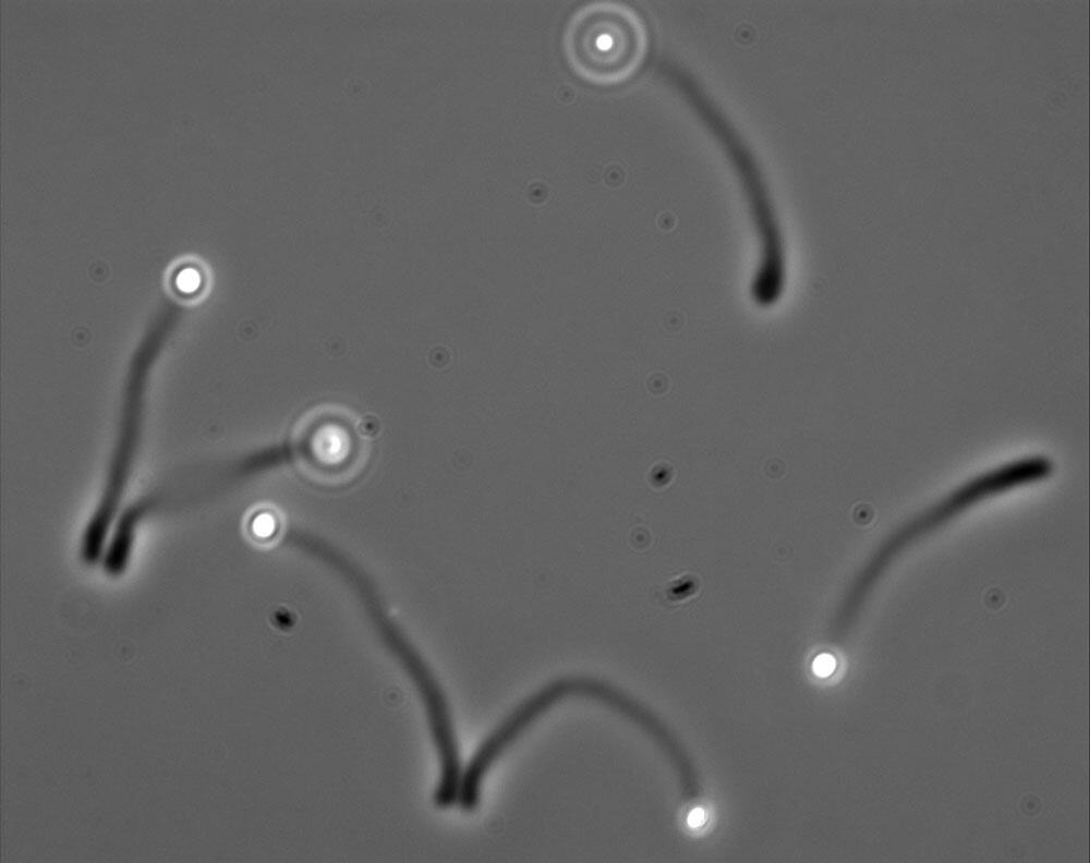 balls of actine