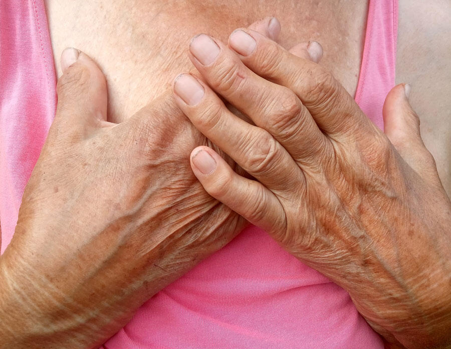 Hands of an elderly woman suffering from rheumatoid arthritis
