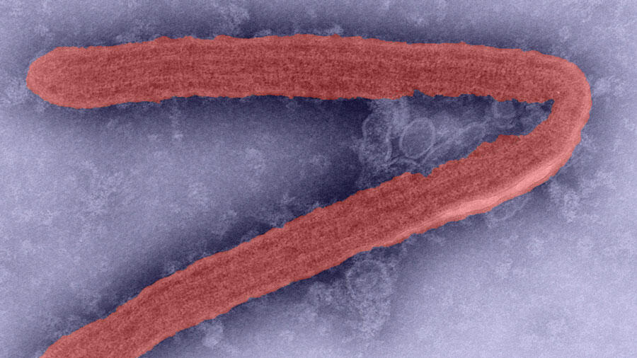 Marburg virus