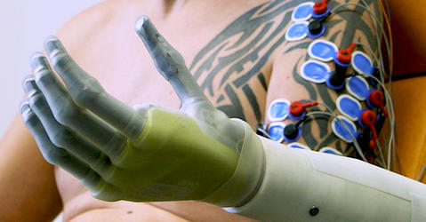 Robotic prosthetic connected to an arm via wires.